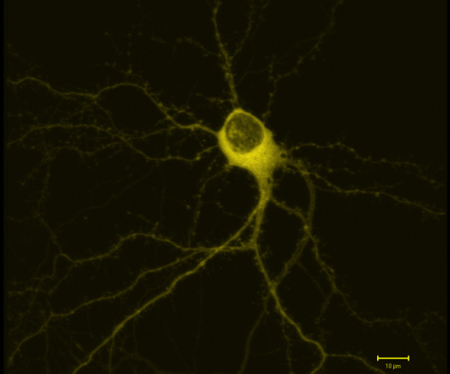 《细胞》：科学家首次证明神经元的形成能清除旧有记忆