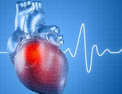 研究发现13种心脏病基因