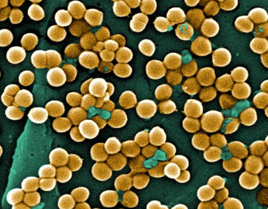 金黄色葡萄球菌引发湿疹样皮疹