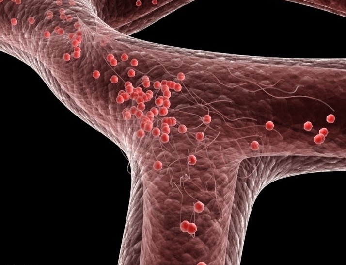 NSAIDs增加稳定性动脉粥样硬化患者脑血管事件风险(Int J Cardiol. 2013 Mar 10;163(3):266-71. )