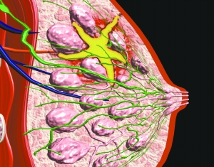 双靶向治疗HER-2阳性乳腺癌优于单靶向方案
