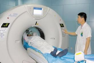 低剂量CT扫描可减少肺癌死亡率