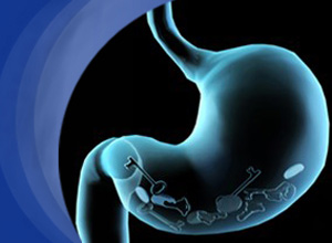多烯紫杉醇可二线治疗难治性胃食管腺癌