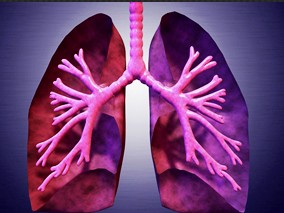肺移植术后阿奇霉素治疗淋巴细胞性气道炎症的疗效