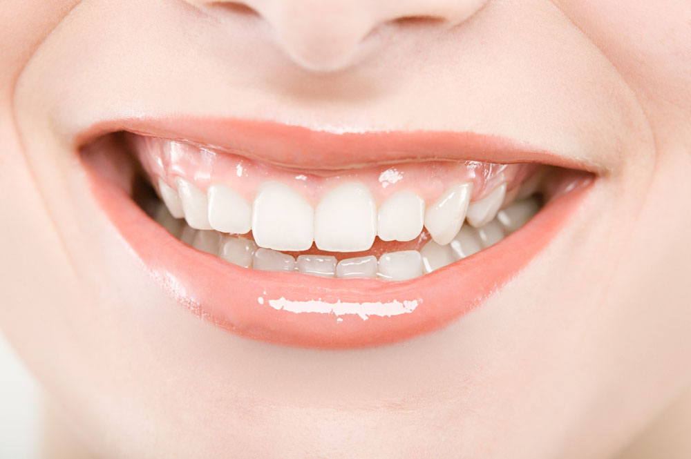 牙髓治疗采用保守洞形或可减少牙齿折裂