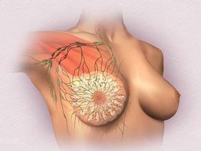 乳腺癌新辅助化疗：添加吉西他滨还是调整化疗方案顺序？
