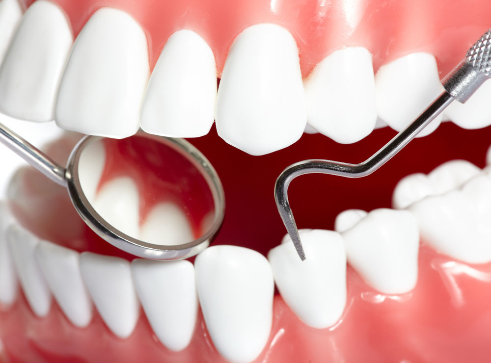 LST有助治疗下颌切牙牙龈重度退缩