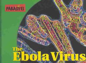 埃博拉病毒尚无治疗疫苗 美加紧试验进度