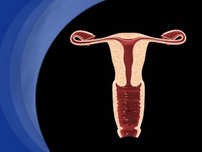 使用左炔诺孕酮宫内释放系统妇女的癌症风险