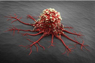 日本发现促使肿瘤产生新血管的基因