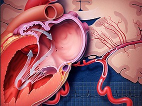 非心脏手术围手术期使用β受体阻滞剂对死亡率的影响