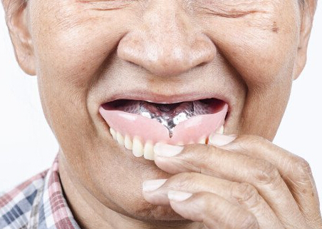 戴义齿入睡增加高龄人群肺炎风险