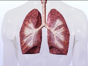 雾化粘菌素治疗与呼吸机相关性肺炎的预后改善相关？