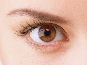 接近正常的角膜SNFL患者在干眼症治疗后CFS和症状显著改善