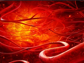 影响早期支架血栓的临床因素和遗传因素