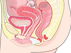 未生育女性宫腔镜诊断前促宫颈成熟：米索前列醇vs地诺前列酮