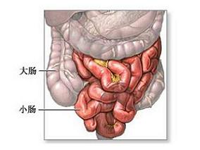 美沙拉嗪治疗腹泻型肠易激综合征的疗效如何？