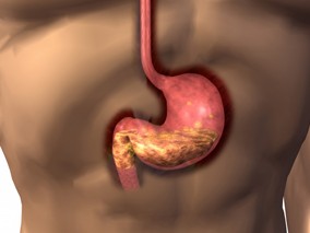钙通道阻滞剂和胃肠道出血之间具有微小相关性