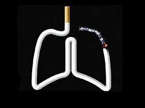 研究发现超过半数“无病”吸烟者或有潜在肺病