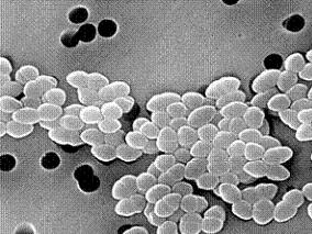 凝固酶阴性葡萄球菌血液感染：万古霉素还是适宜的经验治疗吗？