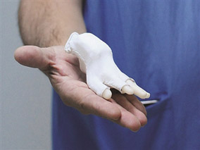 “神奇手套”可预防婴儿猝死