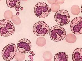 成人复发或难治费城染色体阴性急性淋巴细胞白血病如何治疗？