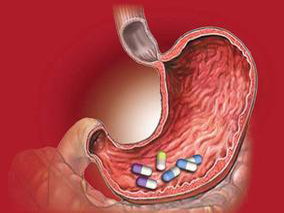 幽门螺杆菌感染患者长期使用PPI对血清胃泌素水平和胃组织的影响