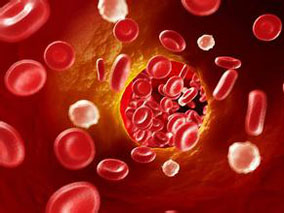 标准疗法联合索拉非尼可有效治疗白血病但增加毒性