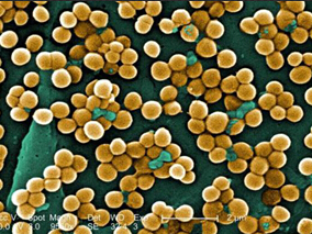 莫匹罗星预防可使非手术患者的金葡菌感染风险降低一半