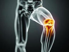 全髋关节和膝关节置换术术后出血风险：利伐沙班vs依诺肝素