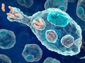 多学科讨论：发现CAR-T细胞治疗用于B细胞恶性肿瘤新的免疫逃逸机制