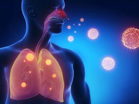 结核分枝杆菌的咳嗽气溶胶可预测接触性肺结核的风险吗？