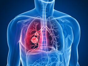 初级医疗降低自限性呼吸道感染患者的抗生素处方的利弊