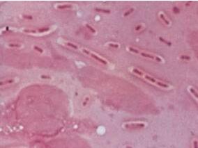 MRSA预防计划对医院感染革兰阴性杆菌菌血症的影响