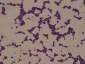 粪肠球菌菌血症患者患心内膜炎的危险因素：NOVA评分的外部检验