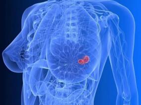 早期乳腺癌患者可从低剂量环磷酰胺和氨甲蝶呤维持治疗获益？