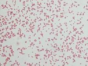 头孢唑林vs广谱头孢菌素用于成人菌血症经验性治疗的疗效