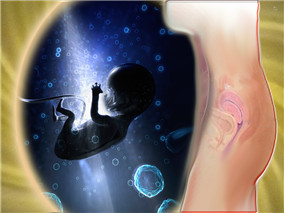 低分子肝素二级预防子痫和胎儿生长受限是否有效？