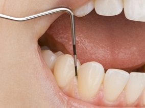 预防牙根管治疗术后感染 不妨试试它