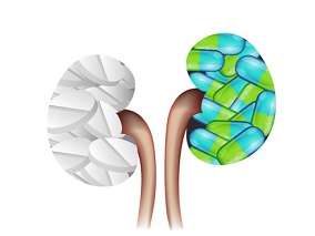 非透析依赖性慢性肾病：CERA低应答或导致较差肾存活