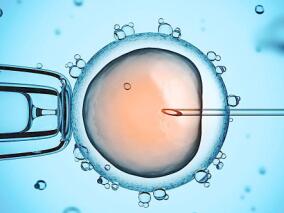 新的模型可个性化预测完整体外受精周期后活胎的机会
