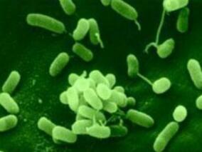 ICU获得性肺炎中多药耐药绿脓杆菌是否普遍？