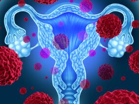 多学科讨论：2009年指南更新后宫颈癌筛查过度与不足加剧
