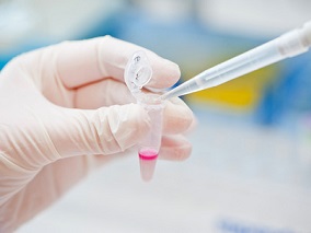 哎呦不错！科学家开发出新型HIV试验疫苗