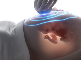心脏机械瓣膜的孕妇应选择哪种抗凝治疗？