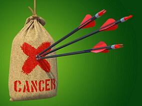 癌症可大大增加患脑静脉血栓的风险！
