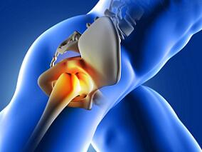 髋/膝关节置换术老年患者预防VTE 华法林低剂量还是高剂量？