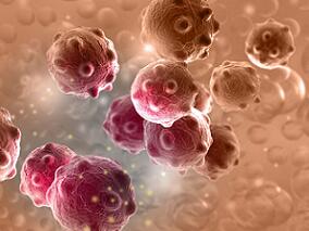 G-CSF预防癌症患者发热性中性粒细胞症安全吗？