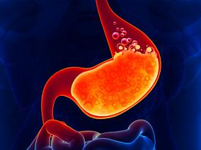 长期使用PPI须谨慎 或增加胃癌风险