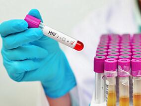 多替拉韦与齐多夫定或替诺福韦联合治疗HIV效果如何？